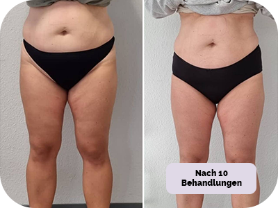 Behandlung