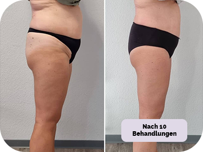 Behandlung