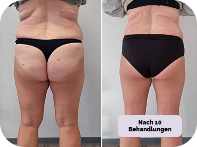 Behandlung