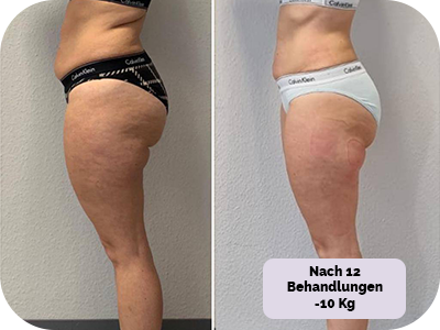 Behandlung