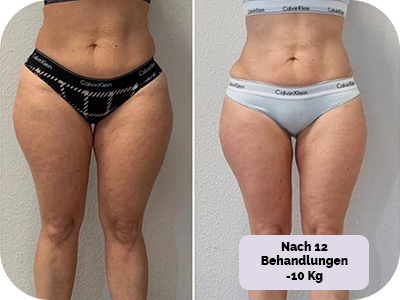 Behandlung