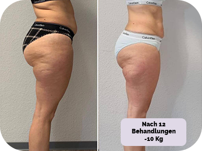 Behandlung