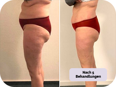 Behandlung