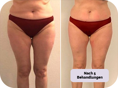 Behandlung