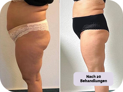 Behandlung