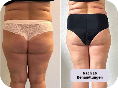 Behandlung